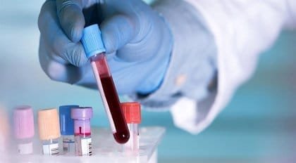 Buscan patentar algoritmo que identifica enfermedades a través de la sangre 11 fotonoticia 20210707104539 420